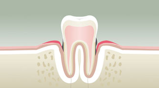 Dentiste Saint Malo